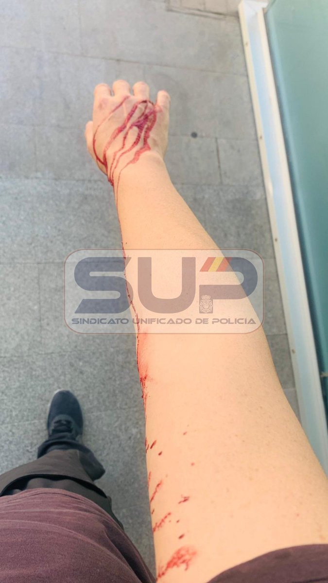 Sup_Policia's tweet photo. Deseamos #ProntaRecuperación a nuestro #compañero agredido brutalmente en Alcantarilla, #Murcia 
#FueraDeServicio asistía a una mujer que sufrió un robo en su vehículo
Fue agredido por 3 hombres en las inmediaciones
Tiene todo el apoyo de nuestro #GabineteJurídico de @SUP_Murcia https://t.co/UD0Y5yy8uA
