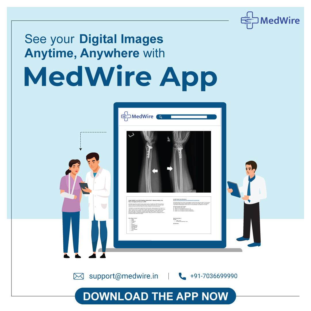 medwire's tweet photo. Gone are the days of carrying bulky X-ray films and waiting for appointments to view your images.

MedWire's digital imaging technology lets you keep your images on your smartphone, making it easier to share with your healthcare provider.

Download now 📲https://t.co/yMPeW2Yj1d https://t.co/SgeBVx1tgY