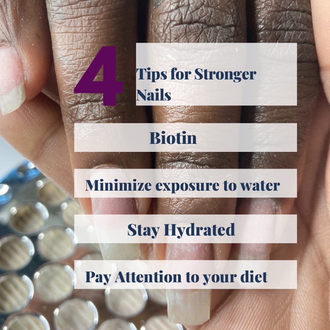 nailz_ondrip's tweet image. Check 👀 out these #nailtips for longer, stronger &amp;amp; healthier nails 💅🏽 #nailfacts #healthfacts #nailtech #lasvegas #nailcare #healthynails #longnails #nailtips