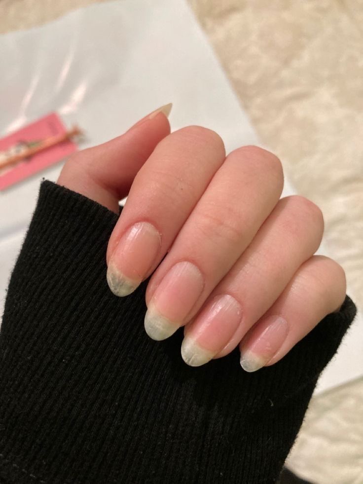 nailz_ondrip's tweet image. Check 👀 out these #nailtips for longer, stronger &amp;amp; healthier nails 💅🏽 #nailfacts #healthfacts #nailtech #lasvegas #nailcare #healthynails #longnails #nailtips