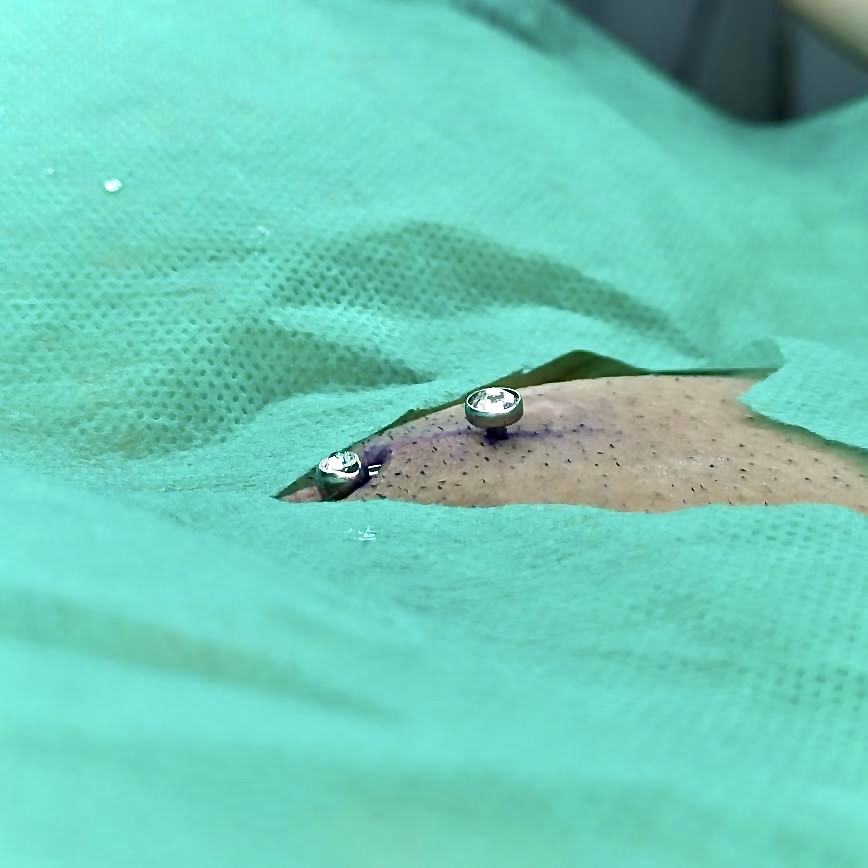 Lizzy_piercer's tweet photo. Christina piercing ✨💫 
Jóia de titânio 
L-bar com 2 pedrinhas
Topo flat pra melhor encaixe na anatomia da região https://t.co/NVVH1TBec4