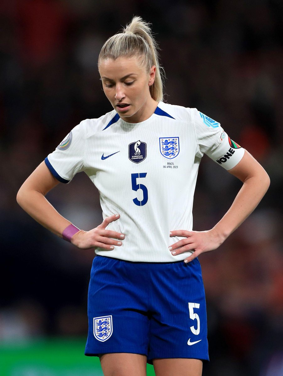 Squawka's tweet photo. Three Arsenal players have ruptured their ACL this season:

◎ Vivianne Miedema
◎ Beth Mead
◉ Leah Williamson

And it's a World Cup year. 😭 https://t.co/fWgkDeBBF4