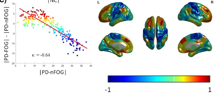 Excited to share a new pub, built on a great collaboration of engineers, med physicists, and clinician scientists. In this project, we identified functional network topologic reorganization and higher-order network disruption specific to individuals with PD and freezing of gait.