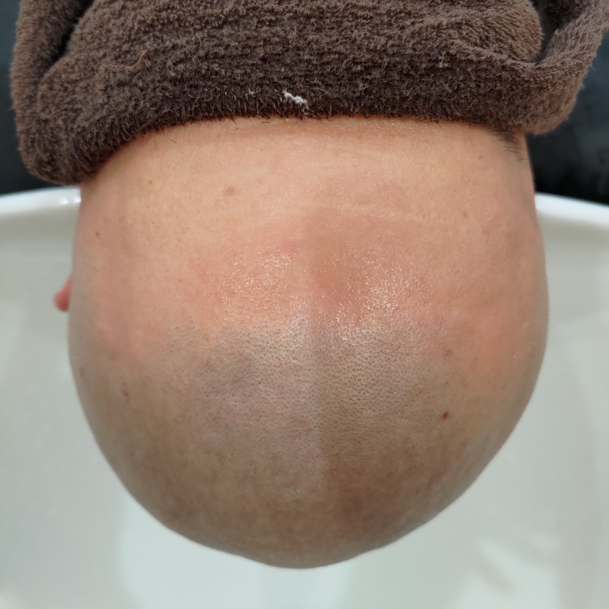 bb_furusawa's tweet photo. スキンヘッドってどんなに丁寧に剃ってもシャンプーするともうひと剃りいけるから不思議。なので寝たままさらに追撃。
あまりのしつこさにお客様から嫌われてしまわないか心配。
でもやっちゃう✨
#剃髪 #スキンヘッド #tonsure #shaving #剃发 #光头党 #理容フルサワのスキンヘッド https://t.co/XgXVOv0eku