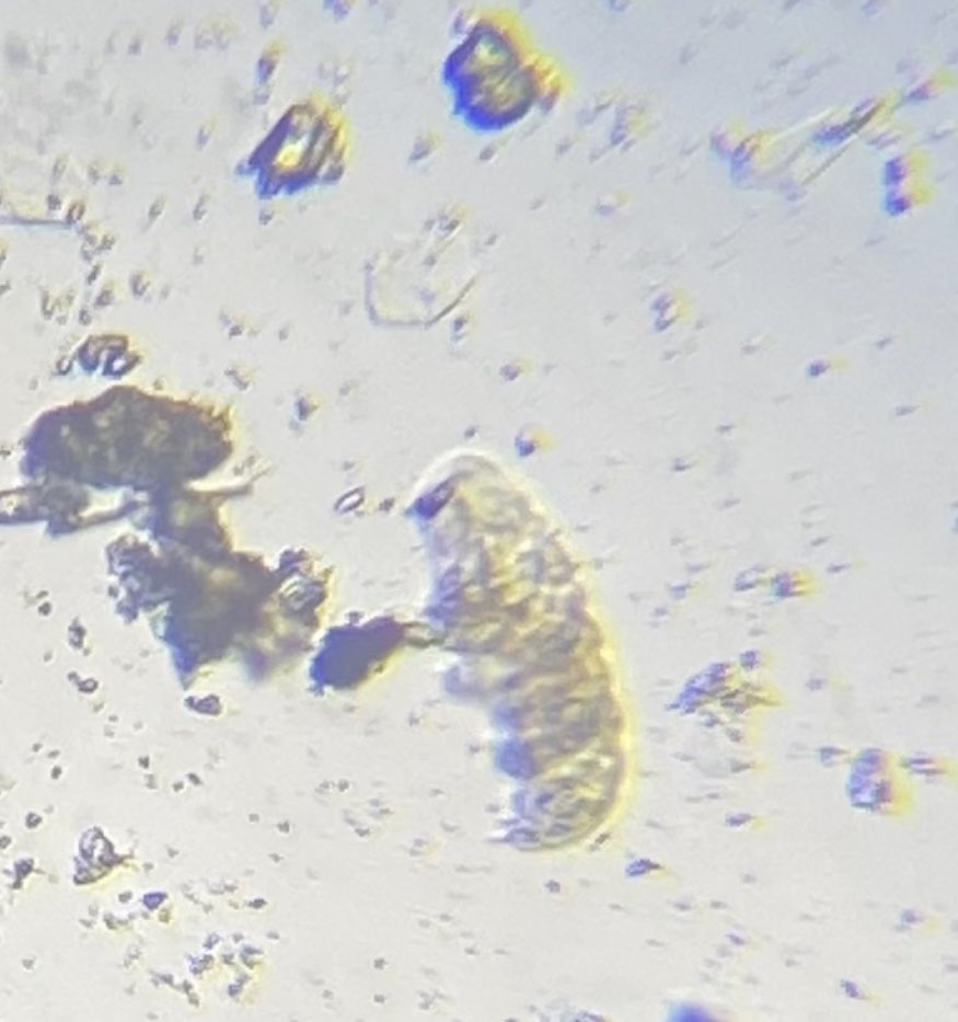 PepScienceSpot's tweet photo. It wasn’t easy, with time and patience we found some tardigrades! #tardigrades 
#waterbears #mosspiglets #microscopiclife
#grade9science #BermudianSpringsHS https://t.co/RY6t4rCP6y