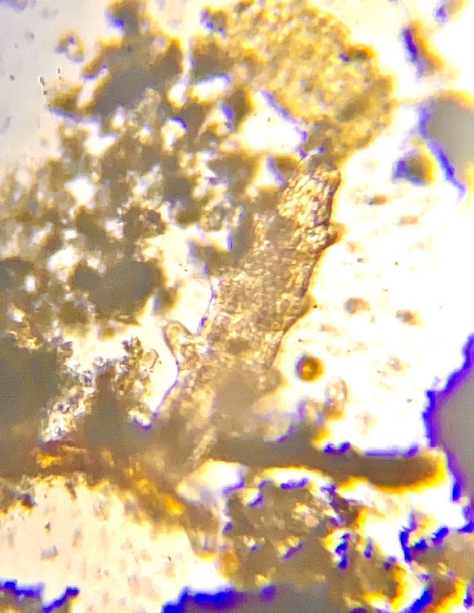 PepScienceSpot's tweet photo. It wasn’t easy, with time and patience we found some tardigrades! #tardigrades 
#waterbears #mosspiglets #microscopiclife
#grade9science #BermudianSpringsHS https://t.co/RY6t4rCP6y