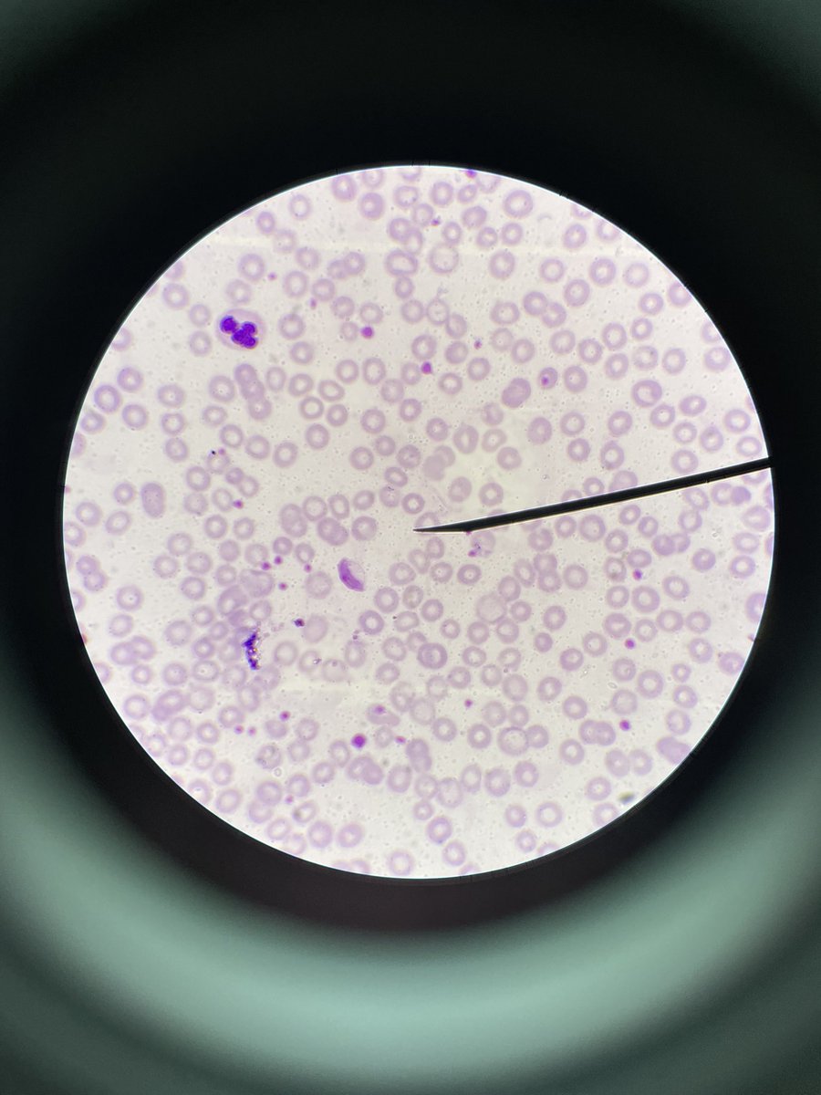 _Feelsnothing's tweet photo. Demonstrated parasite lab https://t.co/4xv6XwPxLB