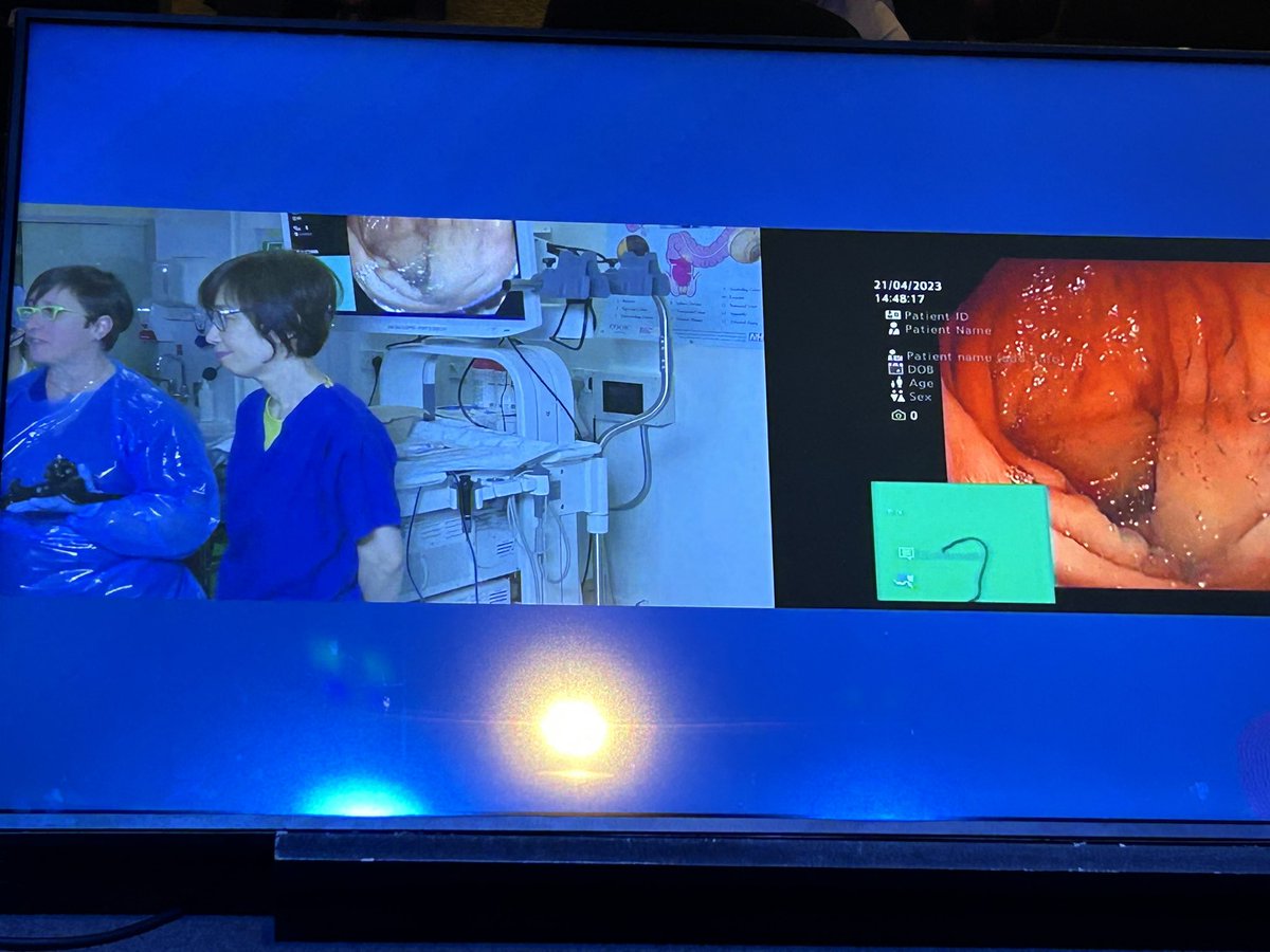 mariapellise (@mariapellise1) on Twitter photo Times are finally changing !! 4 women in a Live Endoscopy Session <a href="/WomeninEndo/">Women In Endoscopy | WIE</a> #ESGEDays2023 <a href="/drmanmeetm/">Dr Manmeet Matharoo</a> <a href="/NorikoSuzuki3/">Dr Noriko Suzuki ๐</a> Times are finally changing !! 4 women in a Live Endoscopy Session <a href="/WomeninEndo/">Women In Endoscopy | WIE</a> #ESGEDays2023 <a href="/drmanmeetm/">Dr Manmeet Matharoo</a> <a href="/NorikoSuzuki3/">Dr Noriko Suzuki ๐</a>