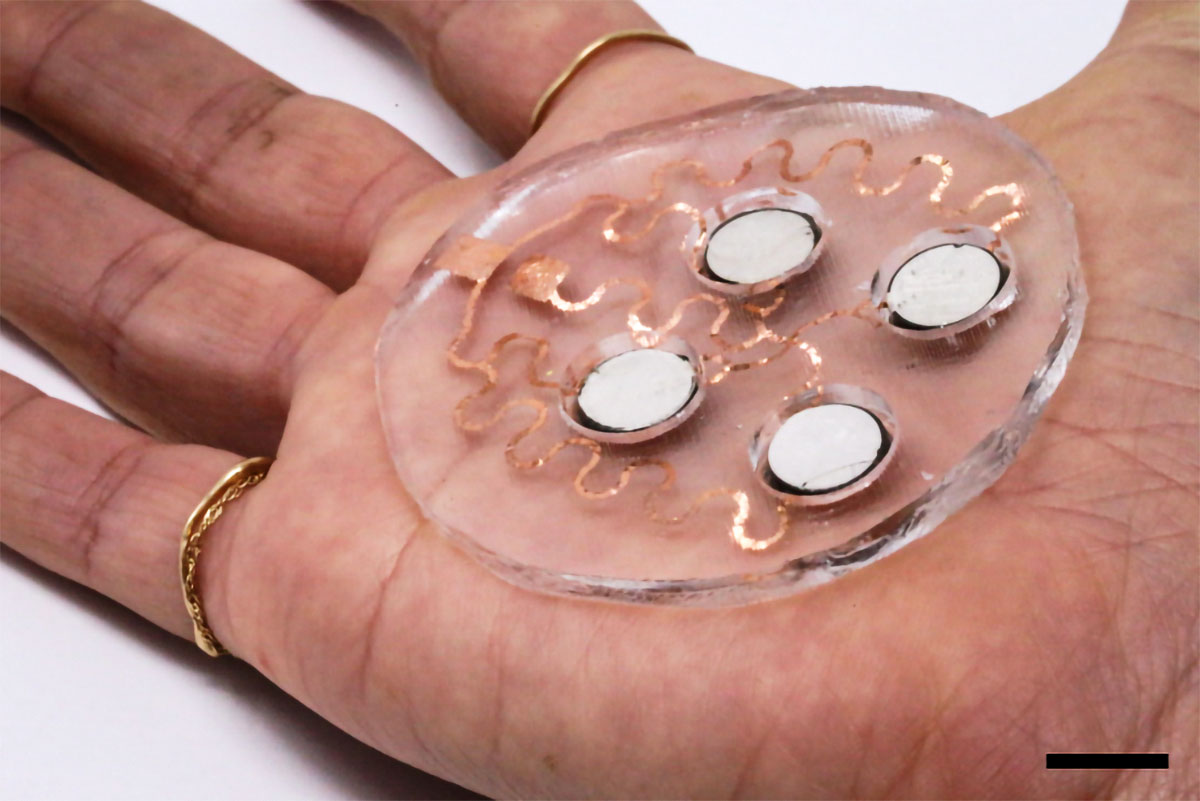 MIT's tweet photo. A new patch applies painless ultrasonic waves to the skin, creating tiny channels that drugs can pass through. Compared to oral medications, “this is a much more targeted, focused modality of drug delivery,” says Aastha Shah. https://t.co/7Hz9yKxfXb https://t.co/3FcxiK5QPy