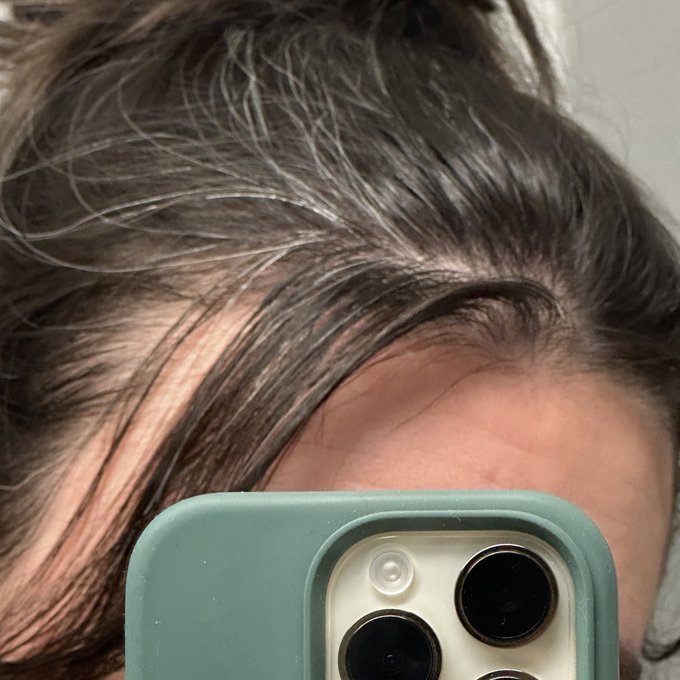 The amount of white hair I am producing is alarming. I&rsquo;m 25 going on 55 apparently 🫠 https://t.co/xt<a href="/tag/twitch"class="tags"><span>#twitch</span></a><a href="/tag/supportsmallstreamers"class="tags"><span>#supportsmallstreamers</span></a>