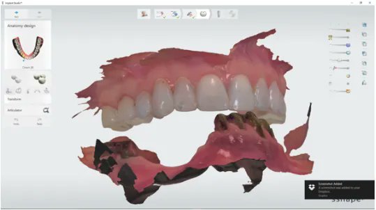 InDentalTech's tweet photo. In case you missed it! #MasterClassFlashback: “Implant Placement Planning and Surgical Guide Design” by Jeffry Tobon, CDT https://t.co/bET2cgaRTl https://t.co/ph7imHlz7w