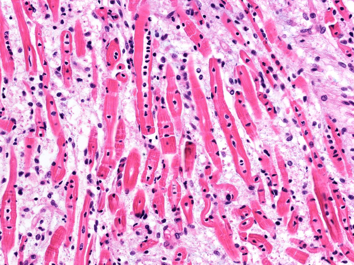 scisignal's tweet photo. Scientists delineate how the protein Oct1 enables #EmbryonicStemCells to differentiate into the #mesoderm—clarifying a key step in development and potentially assisting efforts to engineer cells for regenerative medicine. @jelenapero @UofUMedicine https://t.co/GTSqJ6mib7 https://t.co/x8nCUbbRKX