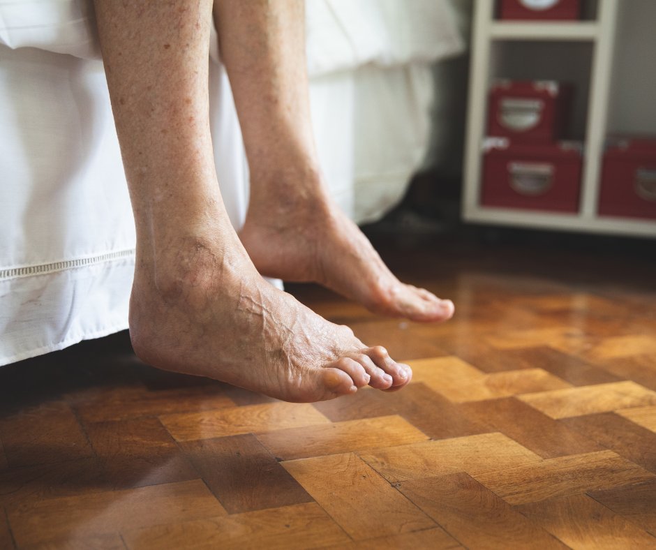 SyracuseFeet's tweet photo. As we age, the health of our feet declines. Syracuse Podiatry recommends all of our senior patients to visit their foot doctor frequently to avoid injury and painful conditions. Call our office today to schedule an appointment! https://t.co/Q48viDhJxi https://t.co/9VKUuKWfcu