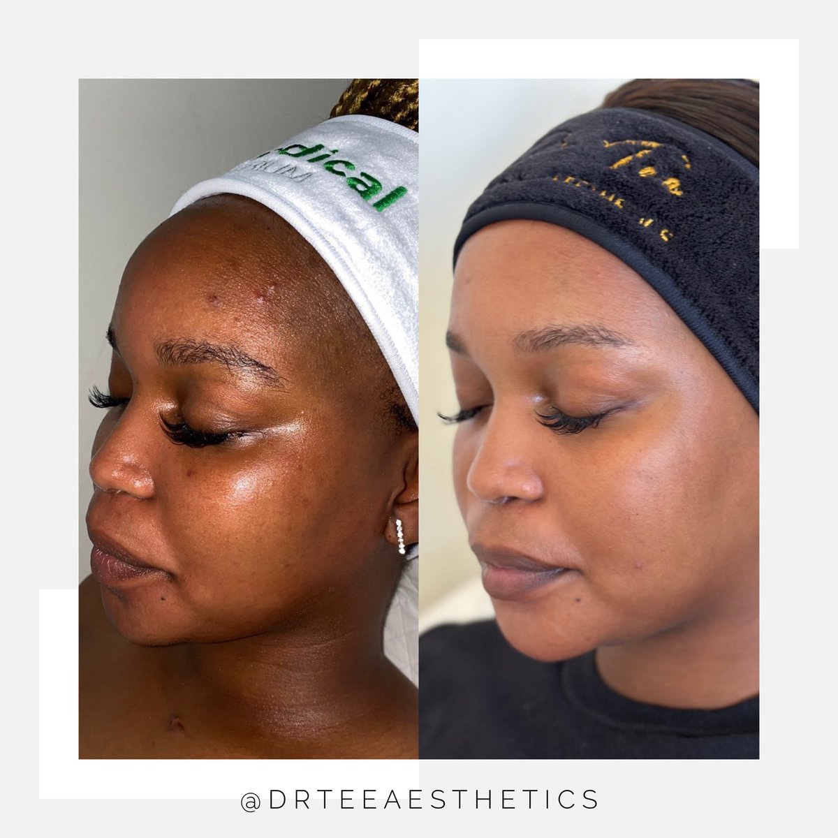 Dr Tee Aesthetics (@drteeaesthetics) / Posts / X