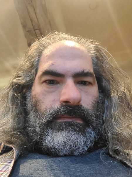 The bandage over my eye has been removed. My vision is *way* better than it was one day after the surgery in my other eye.