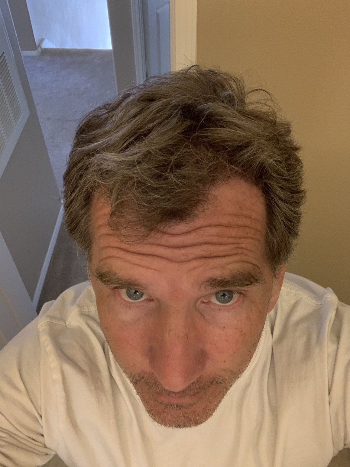 Caveman on Twitter "Gray Hair = Copper Deficiency Aajonus & Ray Peat