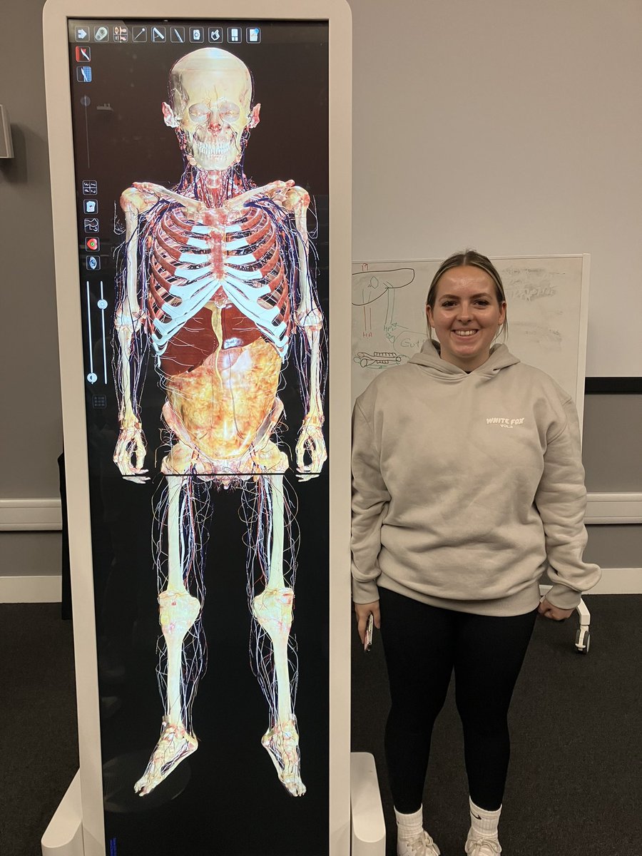 LauraG_cyp's tweet image. Fab #physiology session for NUR6070 at @BCU_CYPnursing with @katsethi safe to say we thought the @AnatomageTable was amazing, along with all the other excellent activities. “I feel like a wizard” 😂 #studentnurse #3rdyear @megaanjamess @TregellesAmy