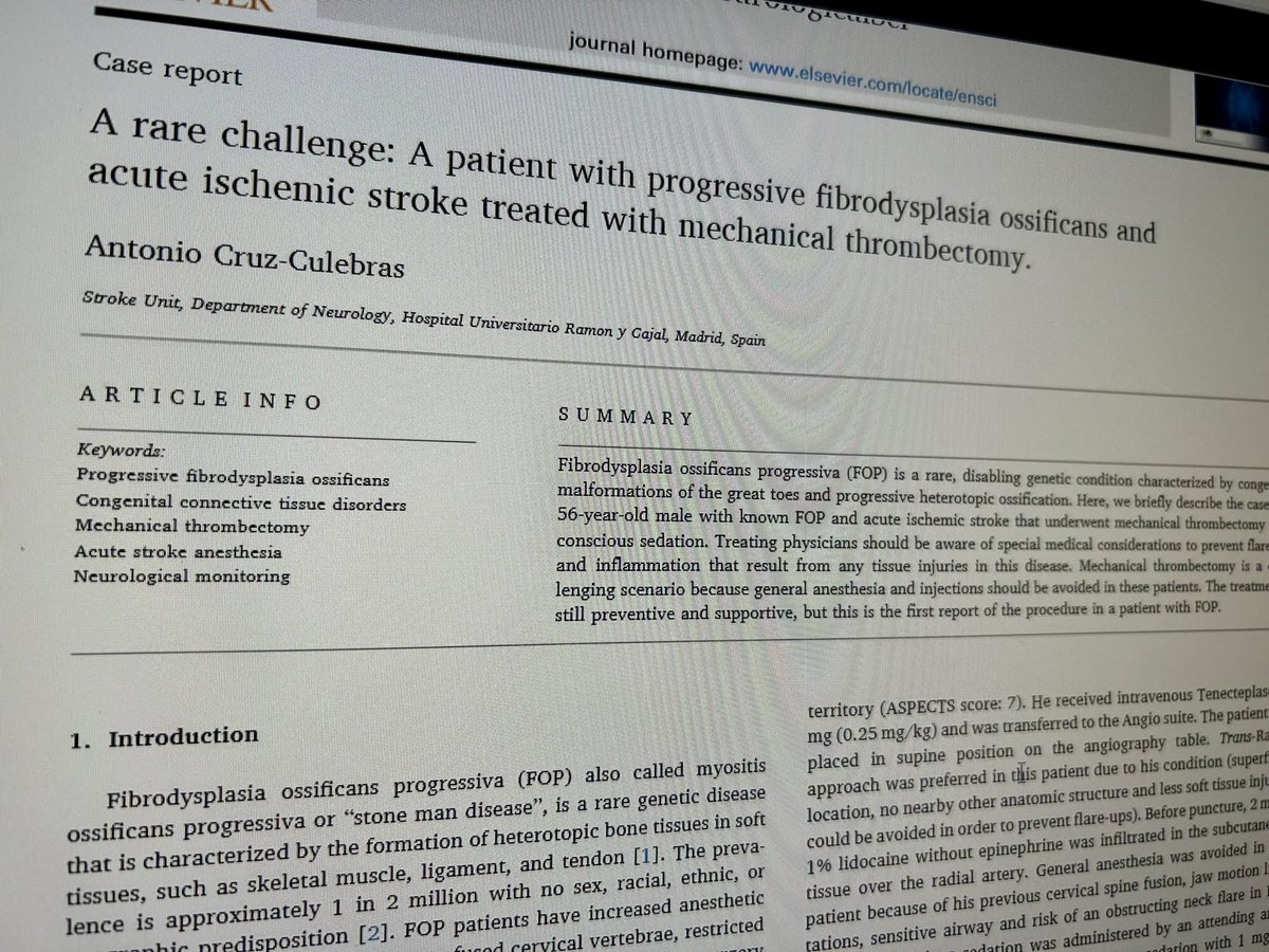 CulebrasCruz's tweet photo. Casos de #ictus tratados mediante #Trombectomía Mecánica en pacientes con #Fibrodisplasia osificante progresiva? 😳 Aquí el primer caso. Próximamente, los detalles #staytuned https://t.co/eG8fLmQSDp
