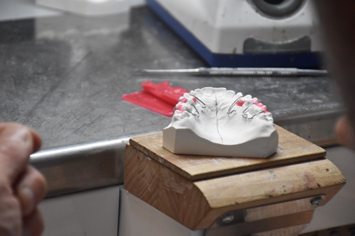 LisideTaranto's tweet photo. #Pcto con la III, IV e V Odontotecnica con la "Ortho Plus" di Nicola Ferrari. Relatore odt Ferrari Nicola. Realizzazione lavoro: Placca di Schwarz @ComuneTaranto @RegionePuglia @MIsocialTW https://t.co/MeZGJu0sAZ