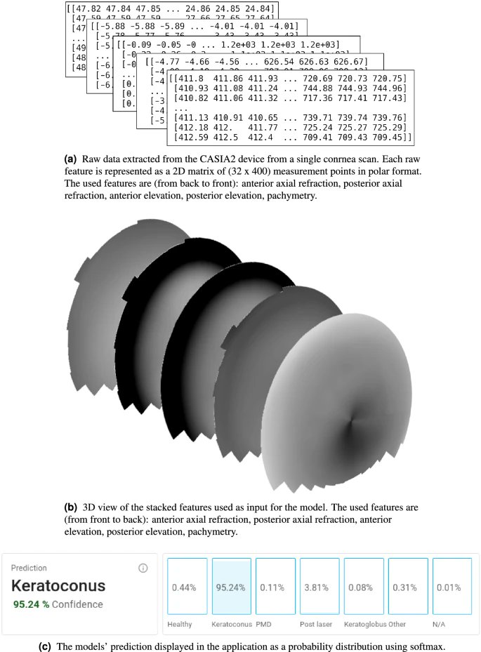 andresvilarino's tweet image. Automated cornea diagnosis using #DeepConvolutionalNeuralNetworks based on cornea topography maps 
#DCNNs #ArtificialIntelligence #AI #ML #MachineLearning #DeepLearning #DL #Algorithm #Data #ConvolutionalNeuralNetworks #CNN #HealthCare #HealthTech  
buff.ly/3KXuOOy