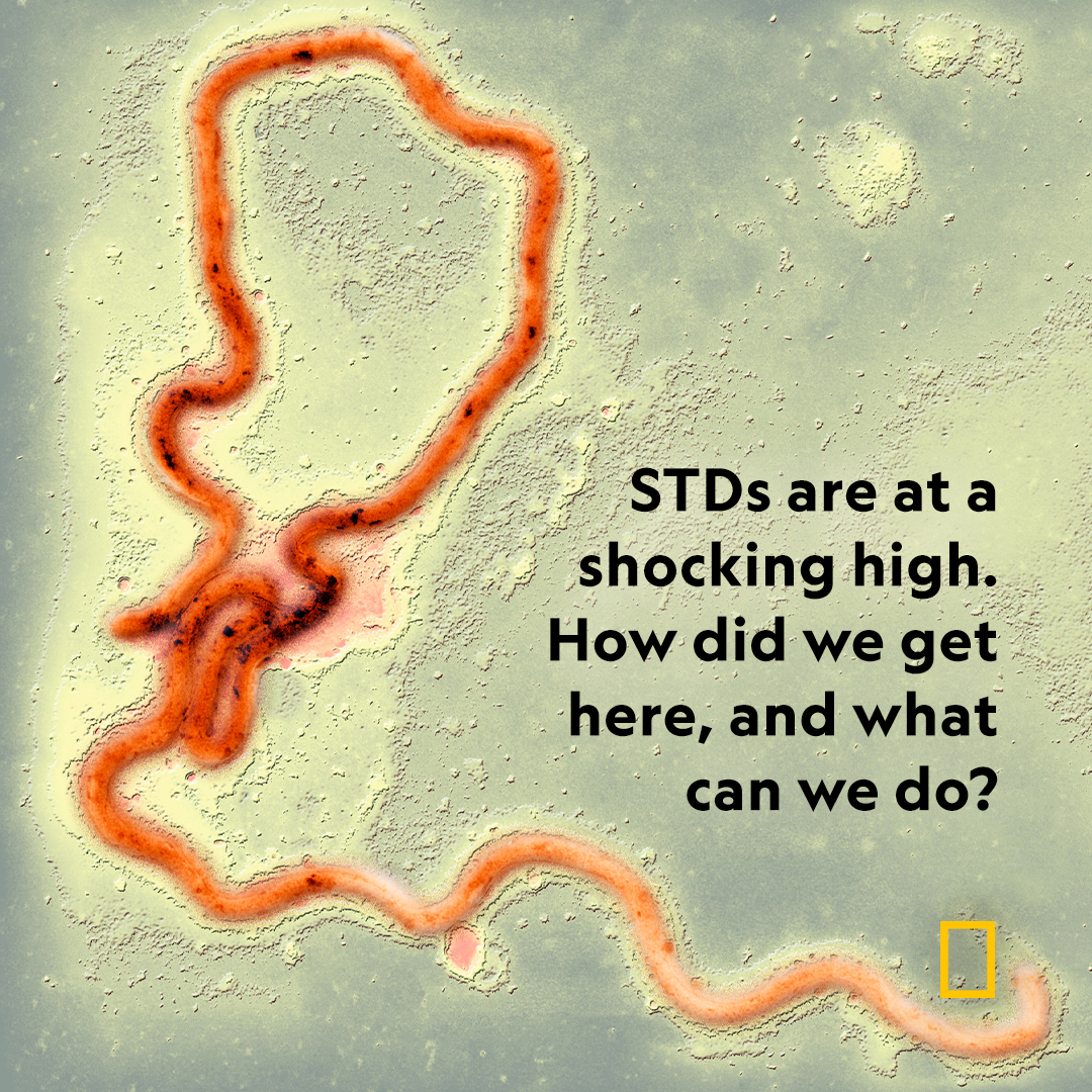 NatGeo's tweet photo. Sexually transmitted infections (STIs) are skyrocketing in the United States and more than half of new sexually transmitted infections were among people aged 15 to 24. Here’s how we got here—and what we can do about it https://t.co/6UlwXt5Yga https://t.co/a1ehvKbBpT