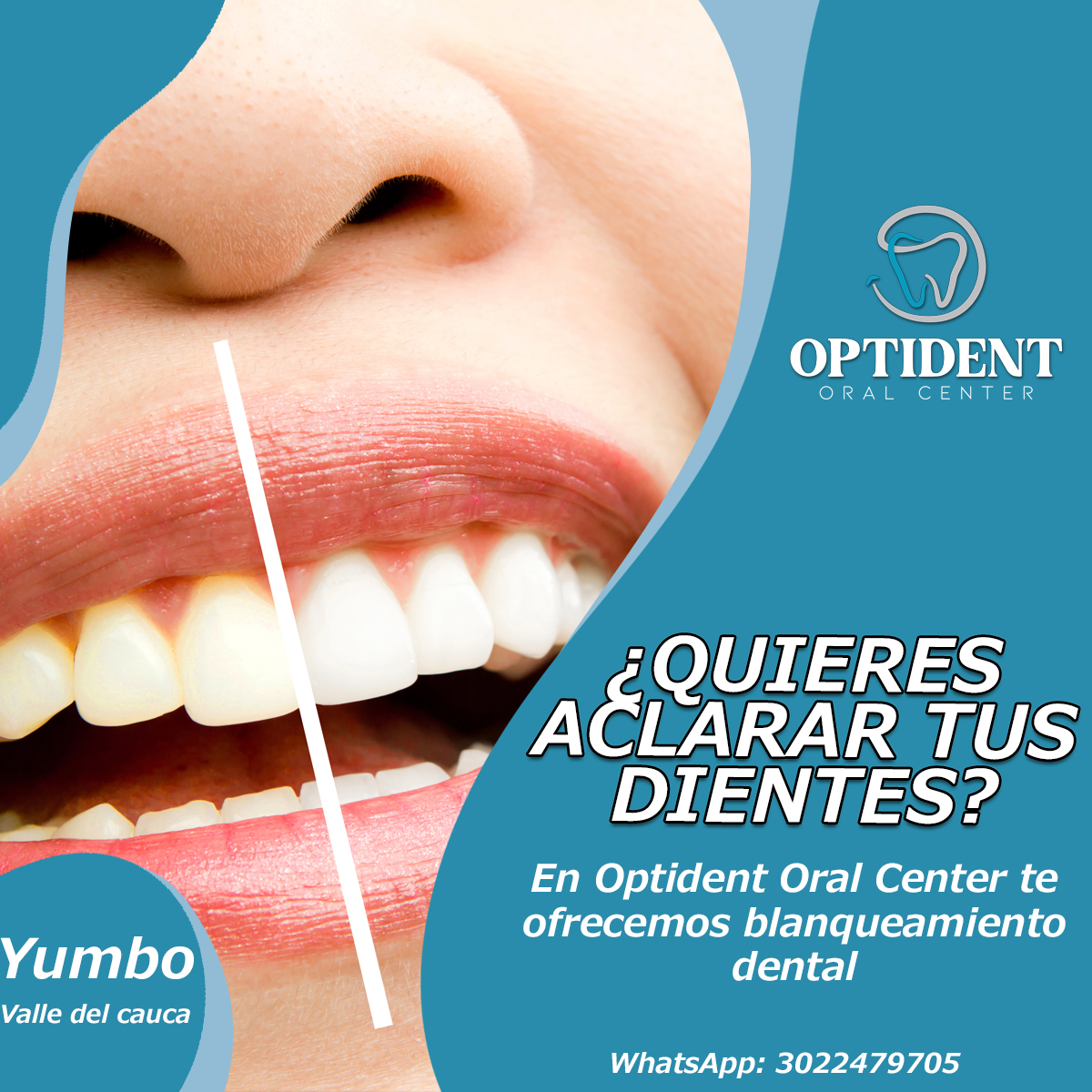 OptidentOralCen's tweet photo. El aclaramiento dental es un tratamiento dental estético que logra reducir varios tonos el color original de las piezas dentales.
WP: 3022479705
#Odontología #blanqueamiento #yumbo #dientesblancos #aclaramientodental #optidentoralcenter #comoaclarar #carbonactivo https://t.co/P1s9tpuNnN
