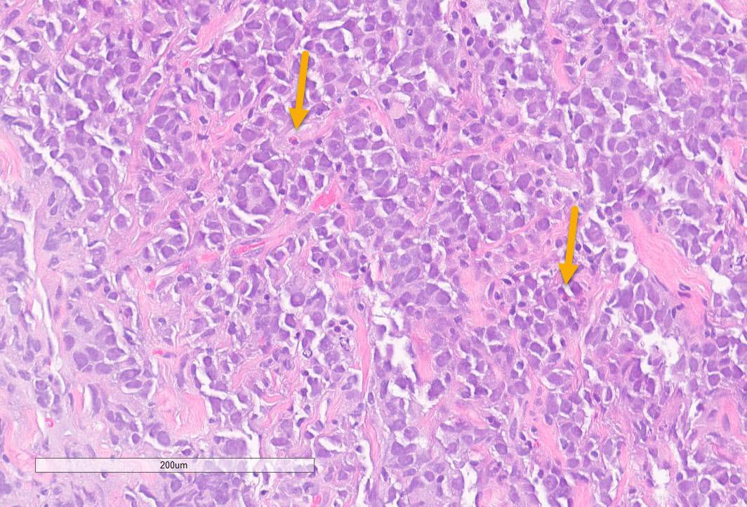 Jerad Gardner, MD on Twitter "RT atman_ci Pathology PathTwitter 