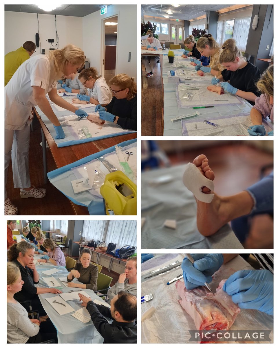 Wij hebben met ons #WEC weer een mooie necrotectomiescholing mogen aanbieden waarbij deelnememde instanties zelf ook een wondcasuistiek presenteerden. Voorafgaand aan deelname werd de theorie getoets middels een e-learning. 
Geslaagde interactieve middag! <a href="/ziekenhuisMST/">Medisch Spectrum Twente</a> #wecmst