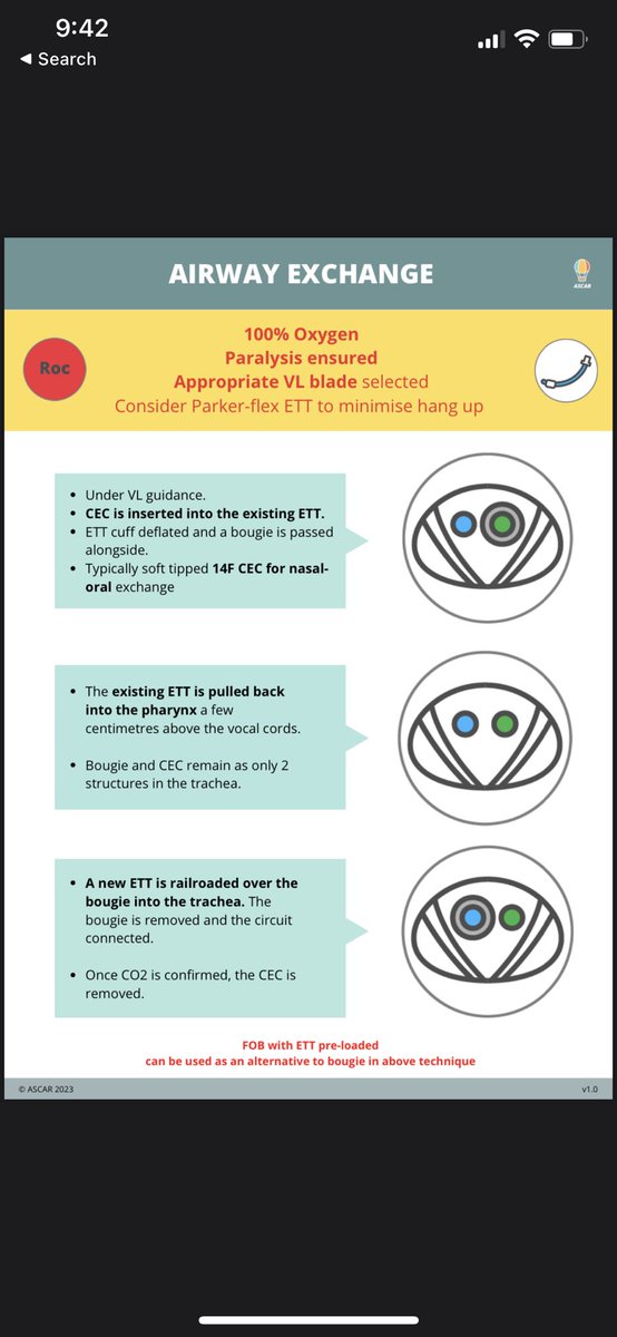 Our approach to nasal to oral ETT exchange 👇 #cognitiveaids #ascar #anaesthesia #anesthesia #icu #anesthesiology #icu #icunurse #ernurse #erdoc #icudoctor #foamed #medicalstudent #medicalschool