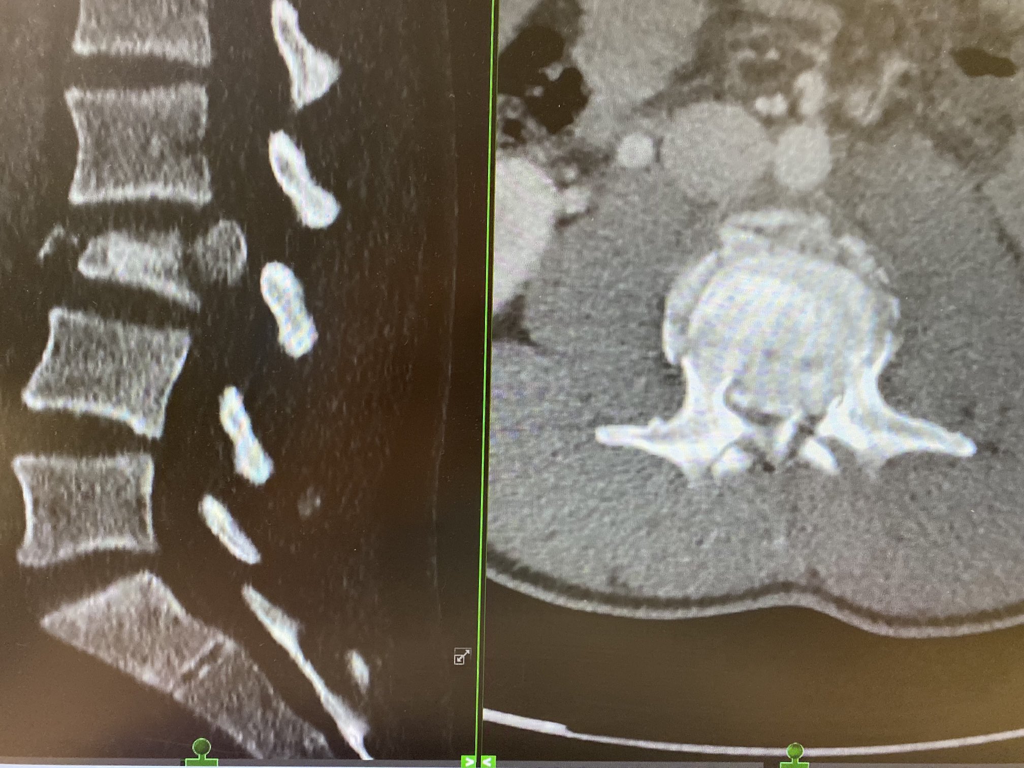 Michael Galgano MD on Twitter: