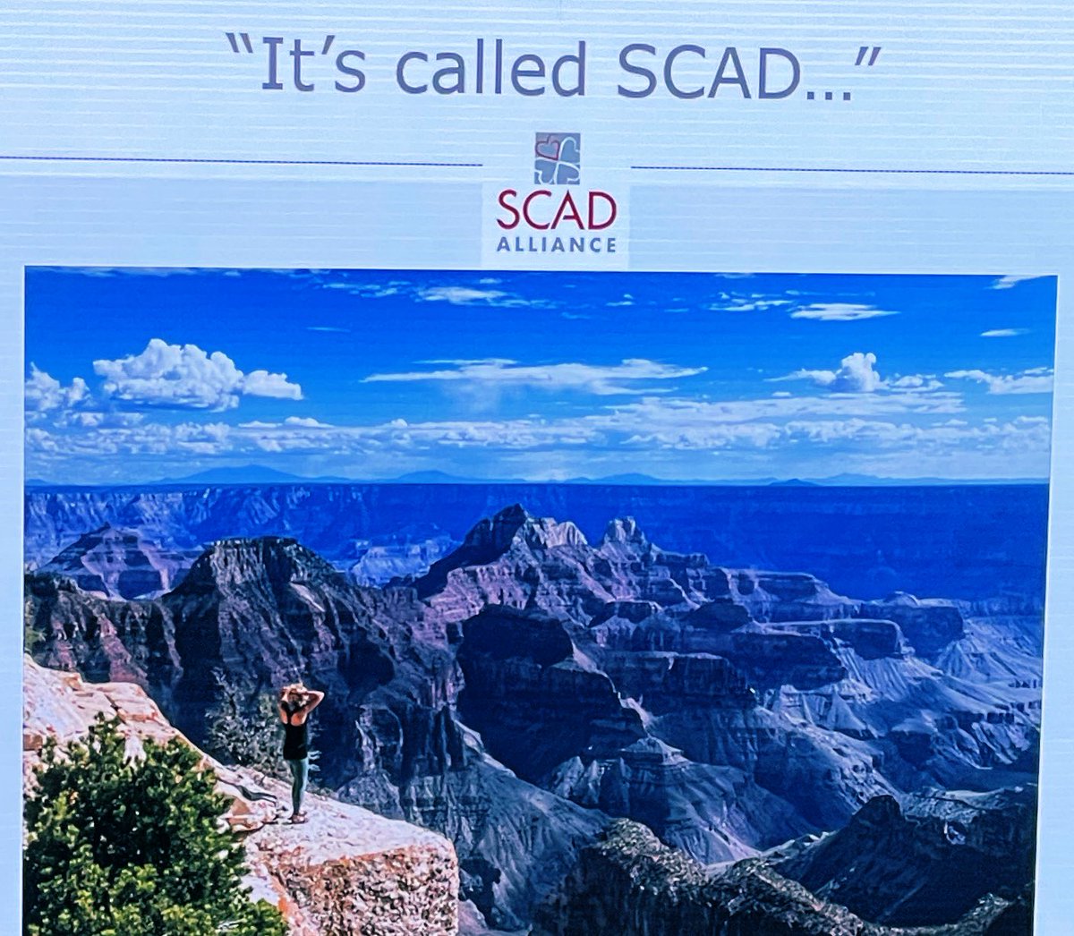 Sonia Tolani MD (@tolanisonia) on Twitter photo Amazing SCAD conference today! Thanks <a href="/EstherSHKimMD/">Esther Kim</a> <a href="/SCADalliance/">SCAD Alliance</a> and the Izard family <a href="/kathyizardclt/">Kathy Izard</a> for bringing physicians, scientists and patients together to help move forward our understanding of this important disease! #SCAD Amazing SCAD conference today! Thanks <a href="/EstherSHKimMD/">Esther Kim</a> <a href="/SCADalliance/">SCAD Alliance</a> and the Izard family <a href="/kathyizardclt/">Kathy Izard</a> for bringing physicians, scientists and patients together to help move forward our understanding of this important disease! #SCAD