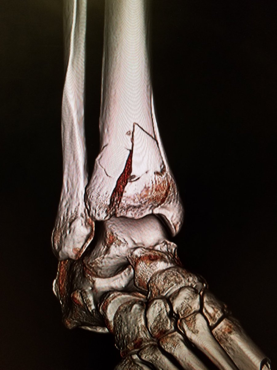 Mike Abernethy 🇺🇸 tweet media