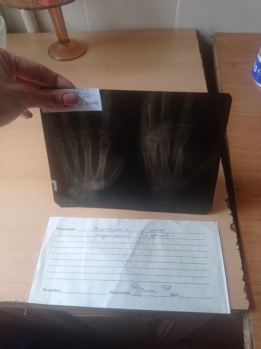 Помогите пожалуйста немного, мне прописали мазь Траумель, у меня нет возможности купить, пожалуйста, у кого есть небольшая возможность - буду чрезмерно благодарна
5354 3210 3031 4927