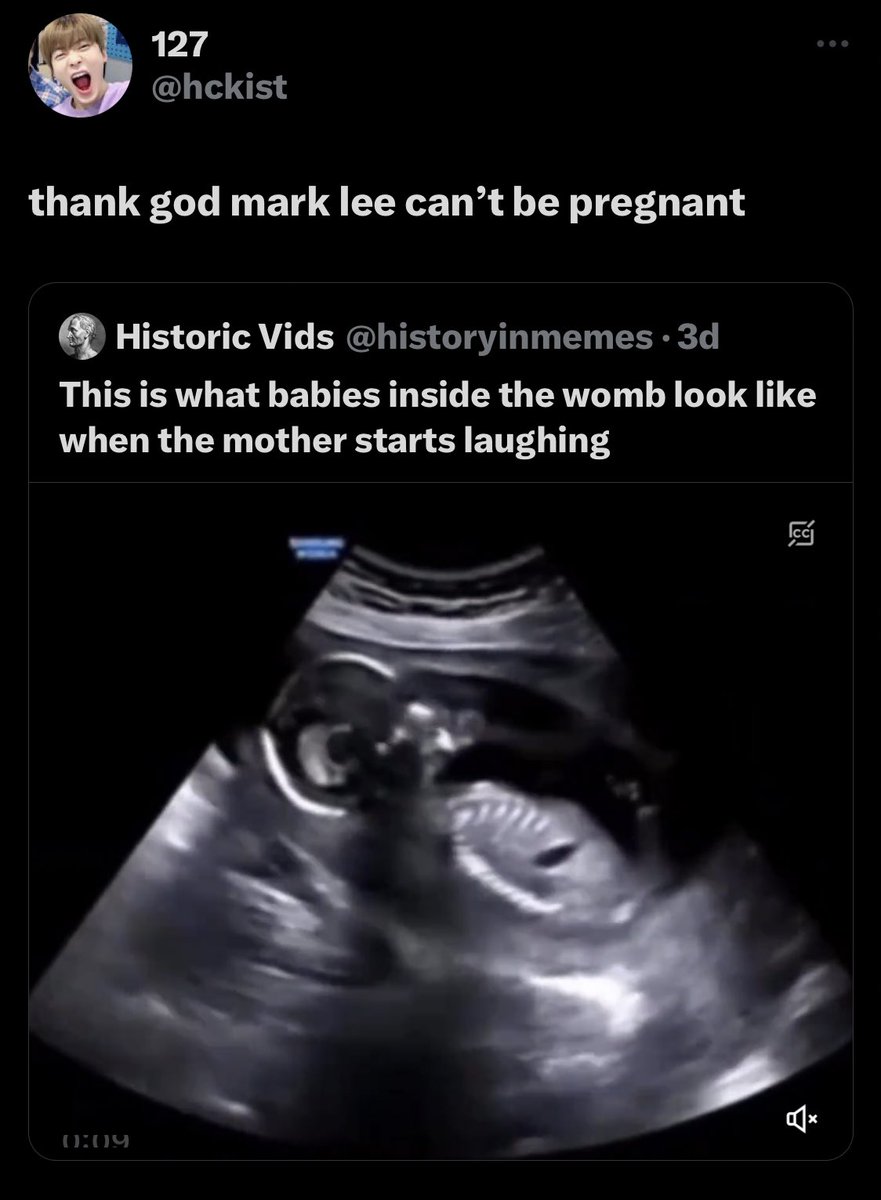ต้นทวิตลงคลิปอัลตร้าซาวด์เด็กในครรภ์ตอนแม่หัวเราะตัวเด็กจะสั่นไปพร้อมกันกับแม่หัวเราะด้วยแล้วคนนี้โควทบอก ขอบคุณพระเจ้าที่มาร์คลีตั้งท้องไม่ได้ โอ้ยยยยเส้นมันแกล้งม้าคกันมาก 55555555555555
