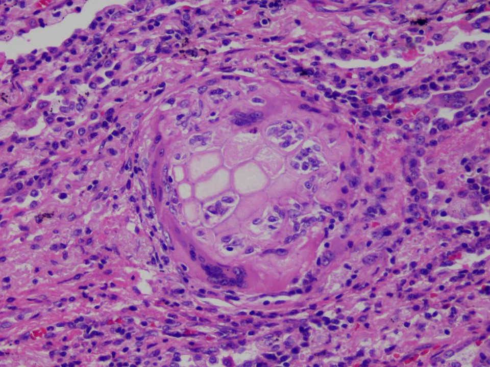 Jerad Gardner, MD on Twitter "RT smlungpathguy Plea to the framers