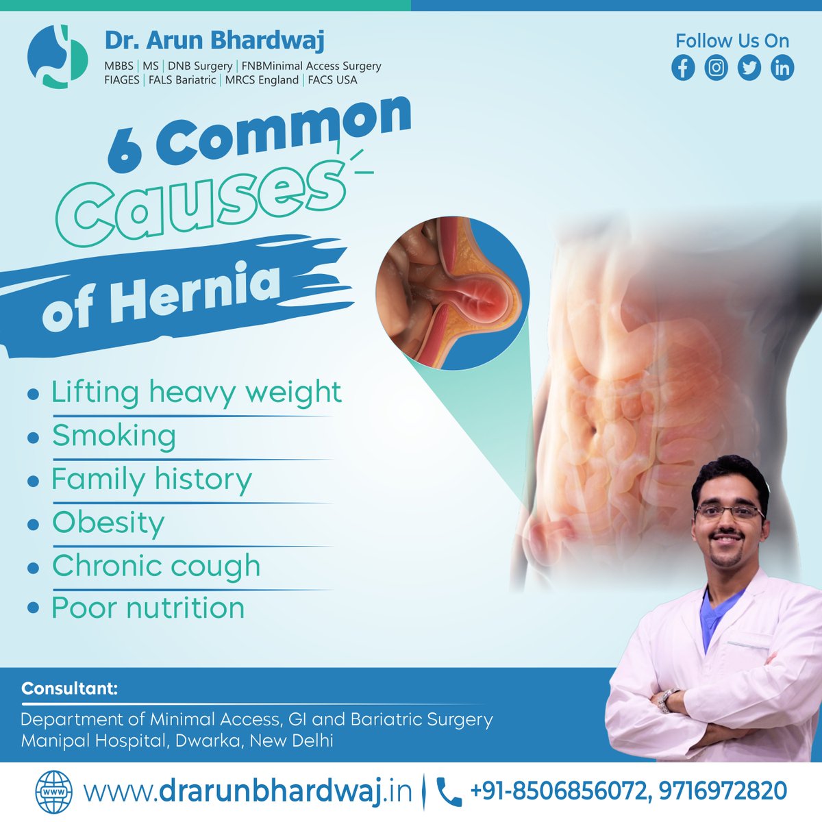 6 Common Causes of Hernia. For a consultation, Call📲 8506856072, 9716972820 also visit💻 drarunbhardwaj.com
#DrArunBhardwaj #laparoscopicsurgeon #bariatricsugeon #laparoscopic #LaparoscopicSurgery #laparoscopicsurgery #drarunbhardwaj #hérnia #HerniaRepair #inguinal