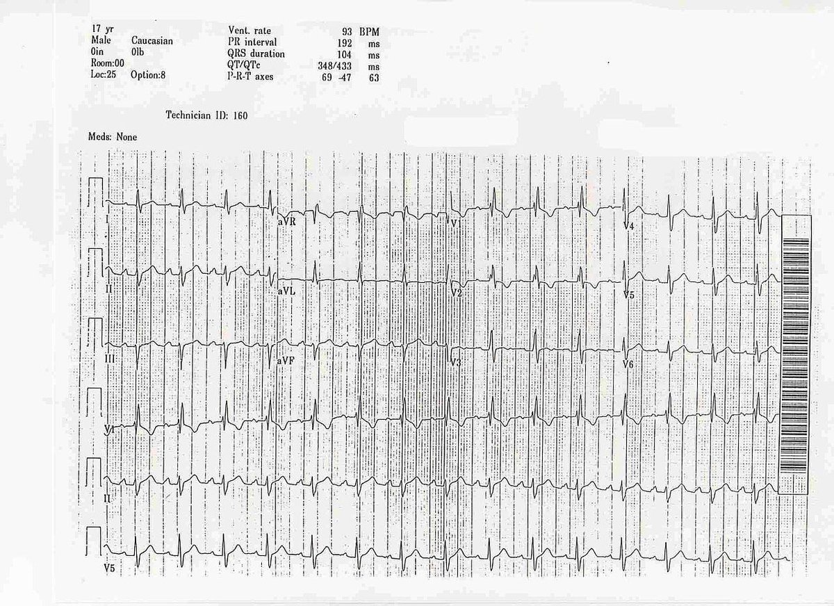 young-lady-with-sob-and-progressive-edema-of-lower-limbs-since-6-months