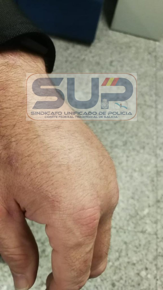 supgalicia's tweet photo. Indignación total al conocer que el presunto autor se trata de un alto cargo del @IgualdadGob

Apoyo absoluto hacia la actuación del #PolicíaNacional herido en el gravisimo suceso del aeropuerto de #SantiagodeCompostela

#SupSeguridadJurídica https://t.co/wyx82EZcrH