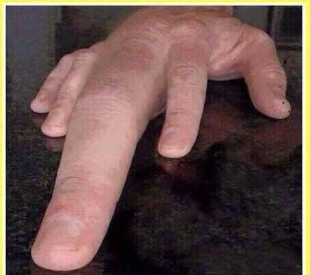 Oficialmente R1 de Urología en el Hospital de Fuenlabrada 🥹👩🏻‍⚕️🫶🏼🩺
🛌💭 came true…