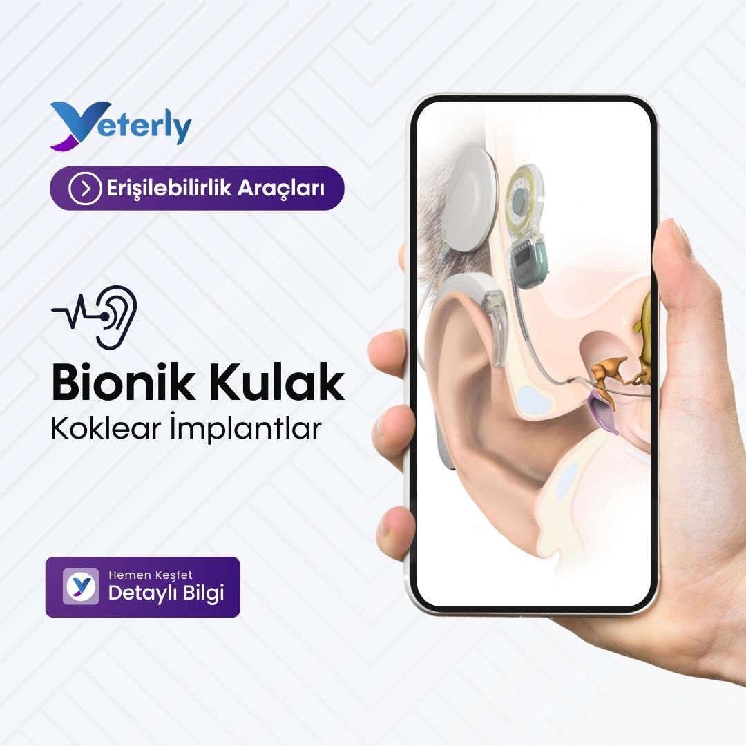 yeterly_app's tweet photo. Erişilebilirlik Araçları | Biyonik Kulak 👏🏻
Biyonik kulak (Koklear İmplantlar), ileri veya çok ileri düzeyde işitme kaybını ortadan kaldırmaya yardımcı bir cihazdır. Biyonik kulak, iç kulak protez veya koklear implant adıyla anılır ve iki ayrı parçadan oluşur. 🎧 https://t.co/8xENPbFtb9