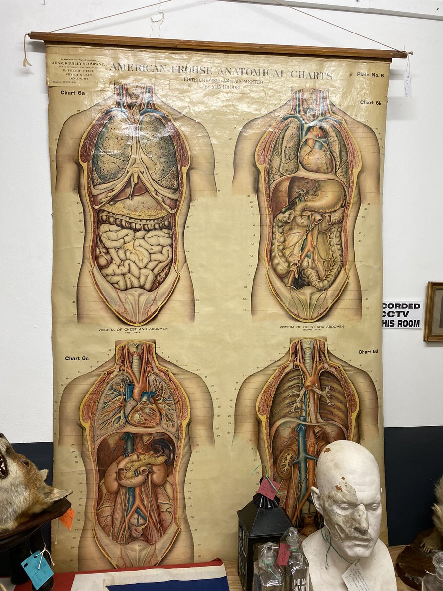 astraantiques's tweet photo. Fantastic American frohse atomical chart from unit 173 #atomicalchart #medical #antiquemedical #americanfrohseanatomicalchart #antiquechart #astraantiquescentre #hemswell #lincolnshire https://t.co/1TH5t3mgb1