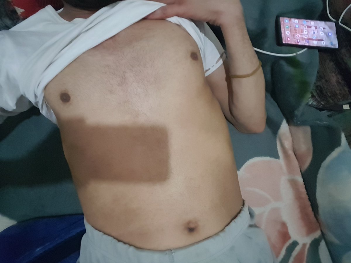 انا مريض بصنغاء بطني وجع وعندي مغص قوي