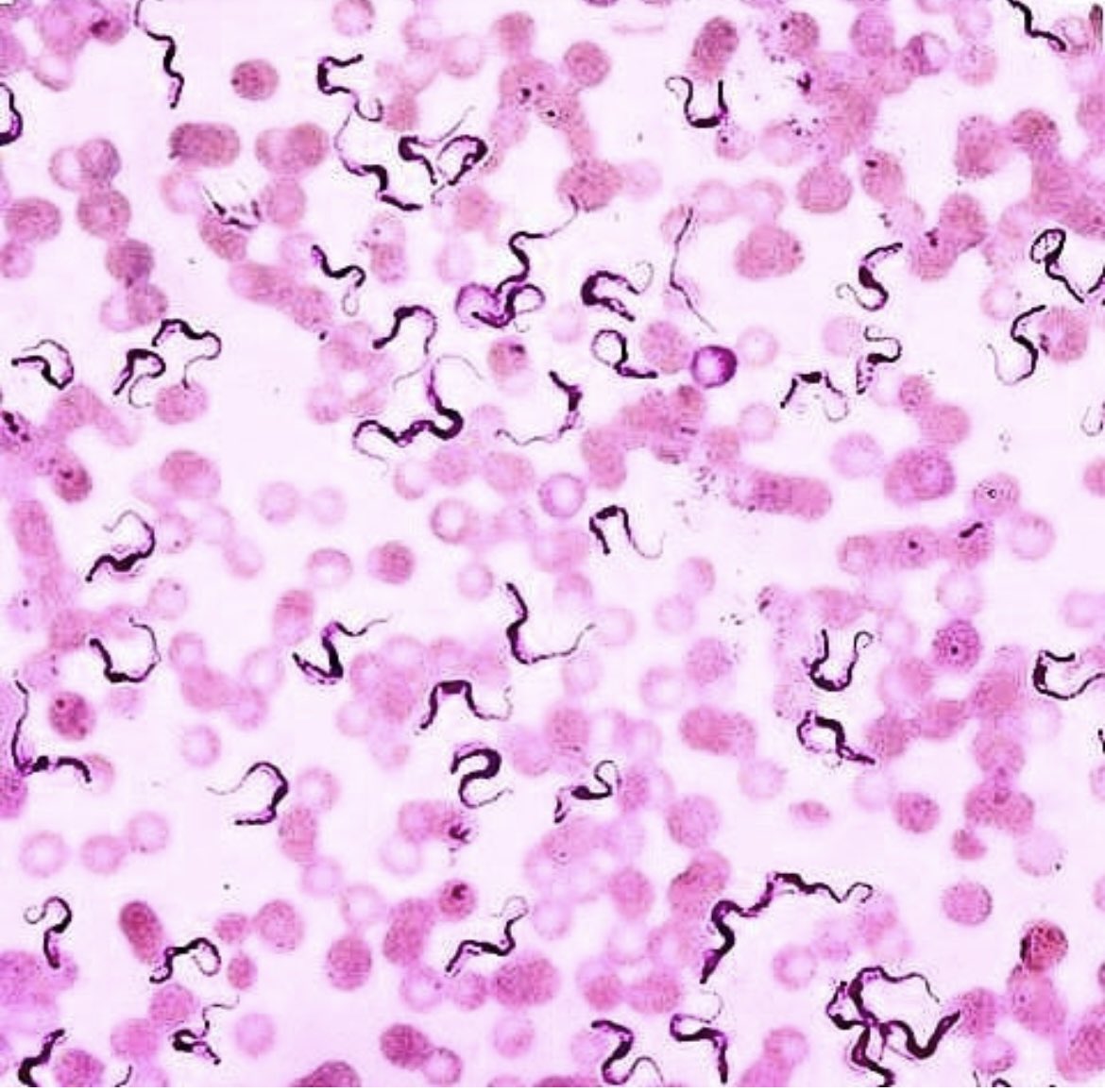 inmunogeno's tweet photo. #enfemedaddechagas #trypomastugote 
Y tú… qué sabes de la enfermedad de CHAGAS ? https://t.co/XqgCCKOnY5