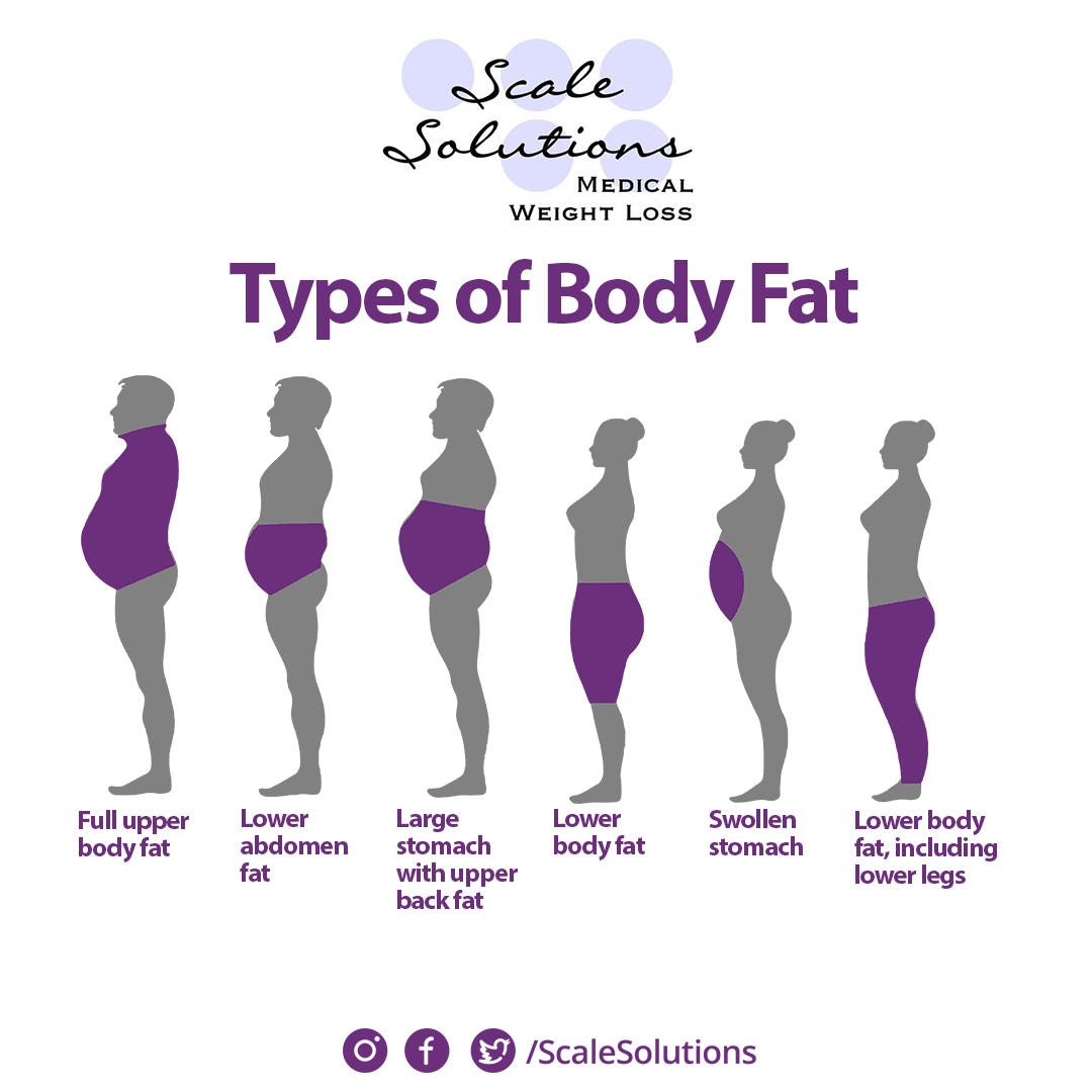 ScaleSolutions's tweet photo. Can you identify which body fat type you have?

In Scale Solutions you will undergo an interview and test to identify your body fat ratio and precisely target this. #bodyfat #weightloss #healhtyliving

Come schedule your first visit with us at:
https://t.co/9sfgFGJTTW https://t.co/Xf4OYdAuHZ