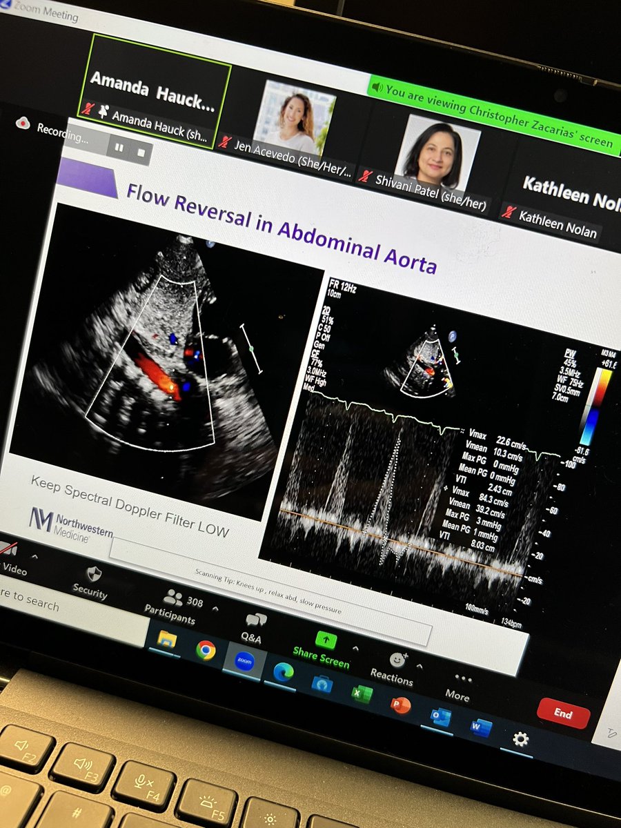 Jen Acevedo (@jennacevedo) on Twitter photo Northwestern’s Brian Fey kicked off our day! #achd #echo #cardiacsonographer #echoeducation #CSU23
<a href="/sheetal_patelMD/">Sheetal Patel</a> <a href="/ShivaniGPatel1/">Shivani G Patel</a> <a href="/angira_patel/">Angira Patel, MD, MPH</a> <a href="/AkhilNarangMD/">Akhil Narang, MD</a> <a href="/jwoomdms/">Joyce Woo</a> Northwestern’s Brian Fey kicked off our day! #achd #echo #cardiacsonographer #echoeducation #CSU23
<a href="/sheetal_patelMD/">Sheetal Patel</a> <a href="/ShivaniGPatel1/">Shivani G Patel</a> <a href="/angira_patel/">Angira Patel, MD, MPH</a> <a href="/AkhilNarangMD/">Akhil Narang, MD</a> <a href="/jwoomdms/">Joyce Woo</a>