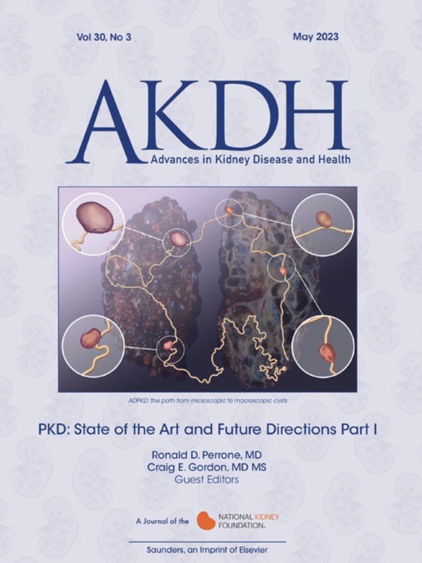 Check out @akdhjournal for the much anticipated issue on PKD. @RonPerrone @Gordon7Craig Amazing contributions by pioneers and enthusiasts. Special thanks to our reviewers! @NKF_NephPros @nkf @ElsevierConnect @K8Williamson @UCKidney @TuftsMCKidney @PKDFoundation @KidneyPatients
