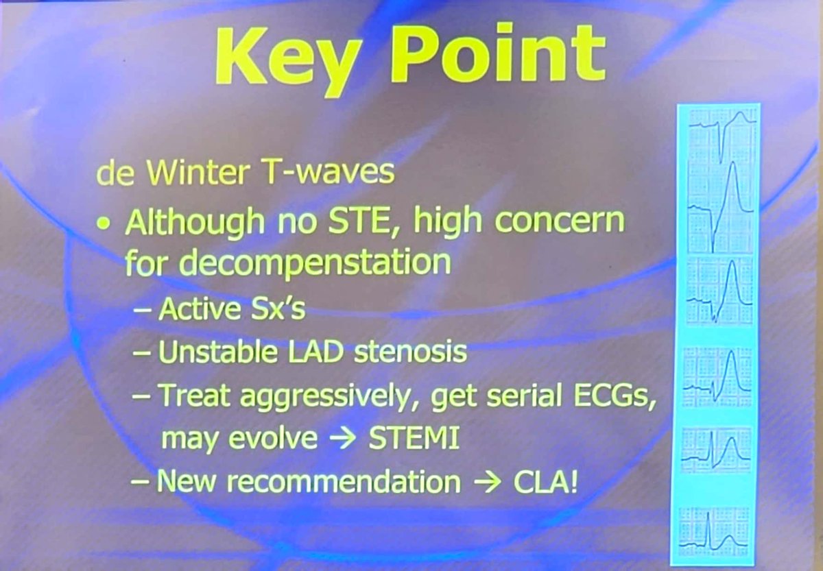 Mark Ramzy, DO, EMT-P (@mramzydo) on Twitter photo <a href="/UMEmergencyMed/">U of Maryland Emergency Med</a>'s <a href="/amalmattu/">Amal Mattu</a> on #EKGs at #AAEM23:
🎯Most commonly missed STEMI is posterior
👇🏽Non STE ACS w/Refractory Ischemia goes to Cath Lab
❤️Sgarbossa in LBBB, RV Pacers & DeWinters now emergently goes to Cath Lab
#FOAMed #CardioTwitter <a href="/smithECGBlog/">Stephen W. Smith</a> <a href="/aaeminfo/">AAEM</a> <a href="/AAEMRSA/">AAEM/RSA</a> <a href="/UMEmergencyMed/">U of Maryland Emergency Med</a>'s <a href="/amalmattu/">Amal Mattu</a> on #EKGs at #AAEM23:
🎯Most commonly missed STEMI is posterior
👇🏽Non STE ACS w/Refractory Ischemia goes to Cath Lab
❤️Sgarbossa in LBBB, RV Pacers & DeWinters now emergently goes to Cath Lab
#FOAMed #CardioTwitter <a href="/smithECGBlog/">Stephen W. Smith</a> <a href="/aaeminfo/">AAEM</a> <a href="/AAEMRSA/">AAEM/RSA</a>