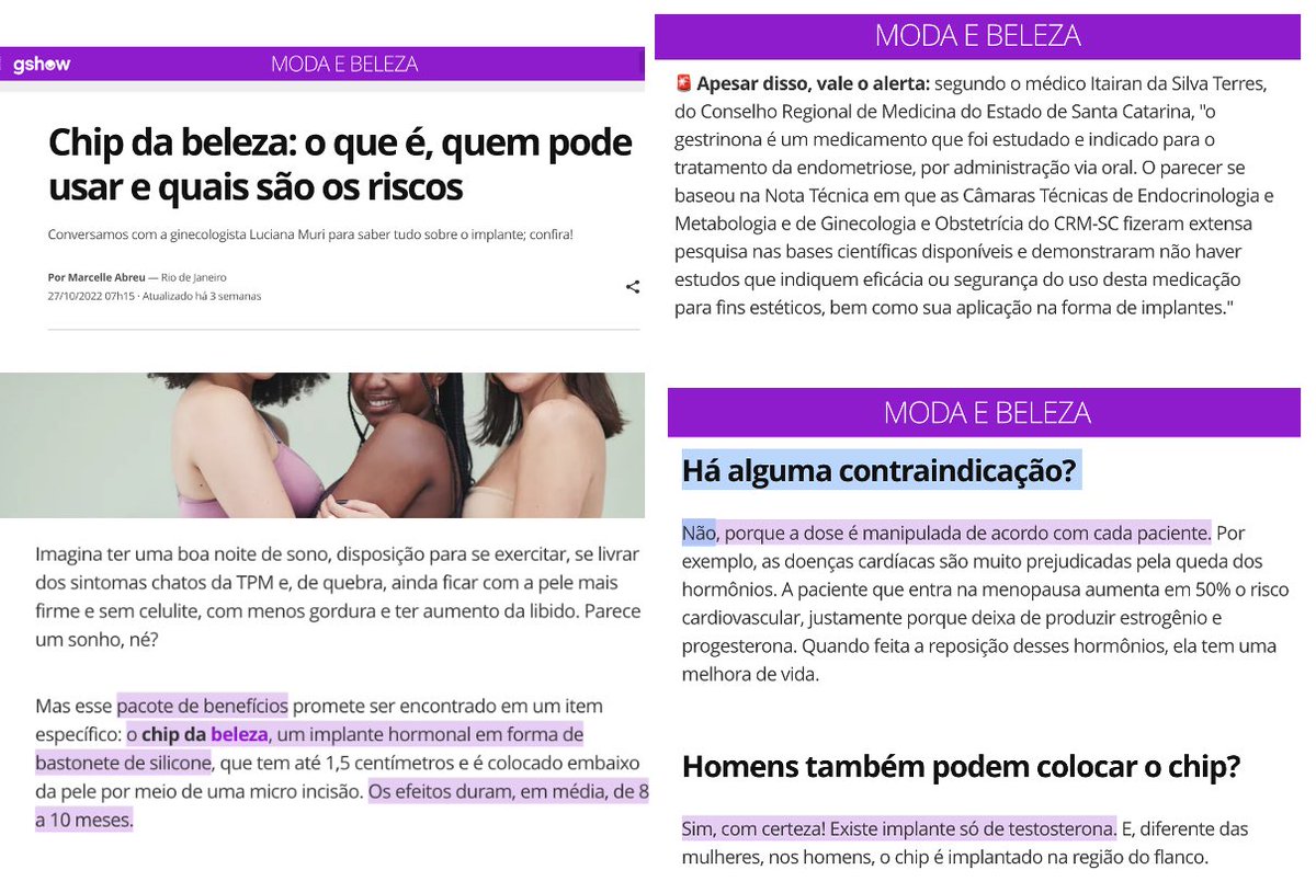 josenalencar's tweet photo. O dois-ladismo da mídia tradicional quando o assunto é pseudo-ciência ou picaretagem em Saúde é um proposital caça-cliques ou simplesmente despreparo?

"Chip da beleza”, uma das mais rentáveis picaretagens recentes: não pode, mas se você continuar lendo a gshow, pode. https://t.co/VEp7VT6BK6