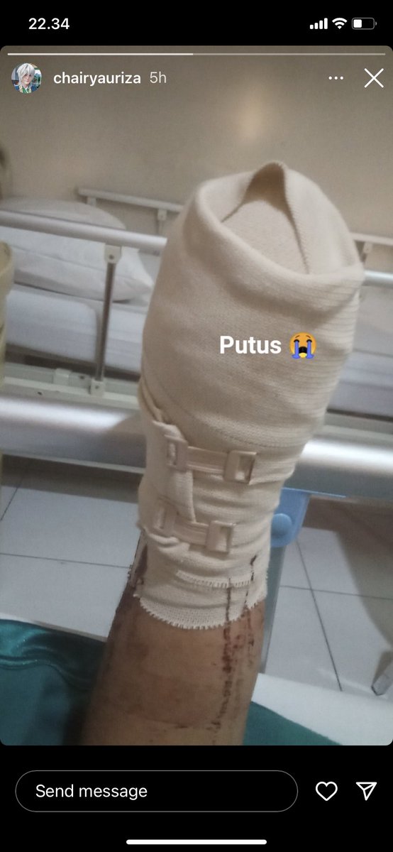 mac_aronie's tweet photo. @gwarntee Btw ini info tambahan update dari IG Chairy (yg bantu upload temennya, jdi temennya yg pake akunnya jadi ga usah bilang boongan, lagi kena musibah malah upload ea) 

Bantu gak bantu urusan kalian tapi kalo gak mau simpati jarinya ga usah ikutan ngetik atau jari lu pada ilang juga https://t.co/ULsmayYDzC