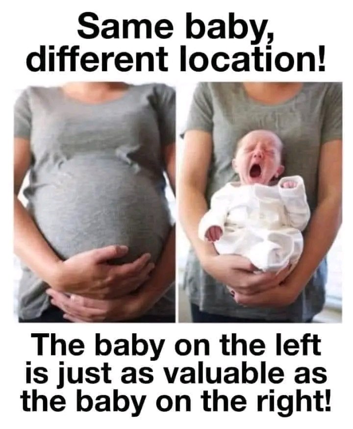 _Anidealworld's tweet photo. @EffEastman @CWforA Science says it is human and has separate DNA. https://t.co/RzWpNFI1Qh